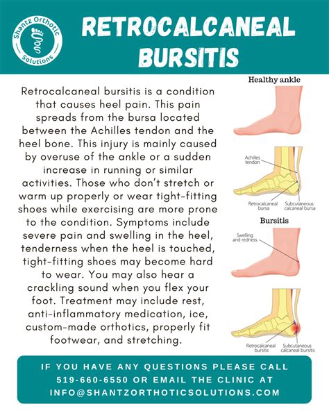 Retrocalcaneal Bursitis