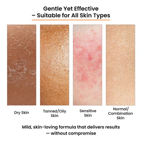 Top 7 Soaps for Pigmentation & Dark Spots, Tan & Uneven Skin in India ...