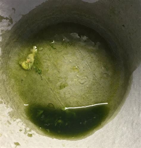 Green Bile Vomit