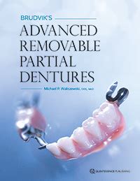 Michael P. Waliszewski | Brudvik's Advanced Removable Partial Dentures ...