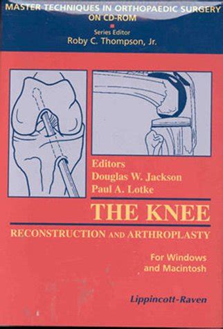 Buy Reconstructive Surgery AND Knee Arthroplasty:oaWindows/Macintosh ...