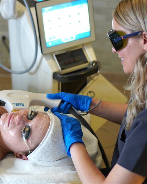 BBL Hero Laser Treatment Boston - Lexington & Wellesley | Bella Santé