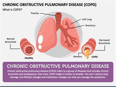 Emphysema Life Expectancy 的图像结果