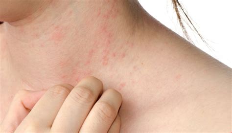 8 Harmful Effects of Eating Too Many Walnuts - lifeberrys.com