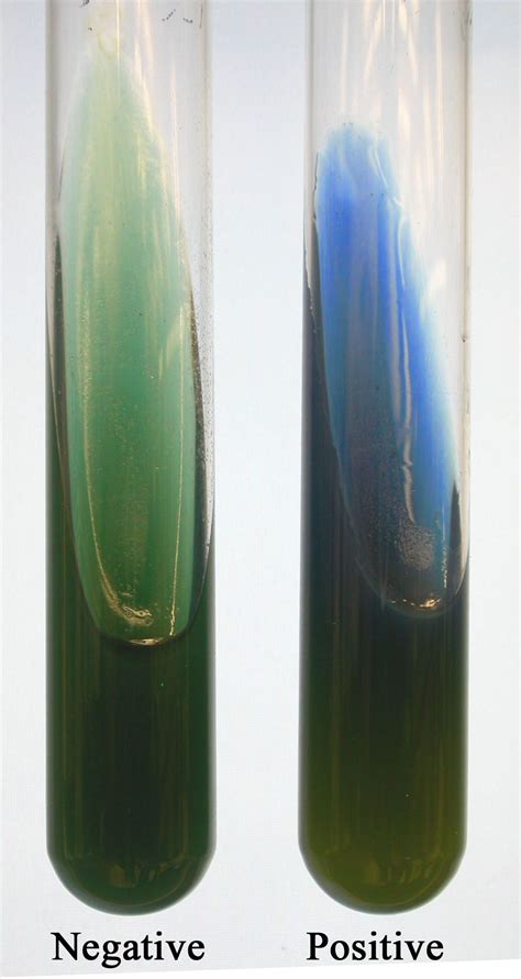 Simmons Citrate Agar | Laboratorios de ciencias, Microbiología ...