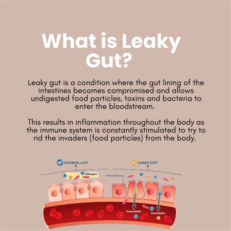 How to Repair Leaky Gut: Rosacea, Eczema, Acne and Psoriasis - Beauty of Inside Out