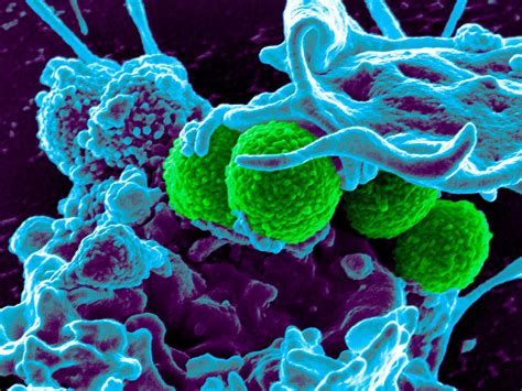 New antibiotic capable of killing superbugs discovered inside the human nose | The Independent ...