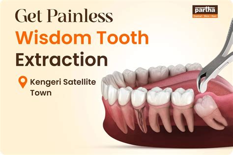 Wisdom Teeth Removal In Kengeri | Partha Dental Clinic