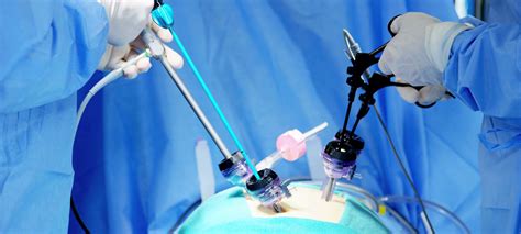 Vivaan Clinic | Advanced Laparoscopic Surgeries
