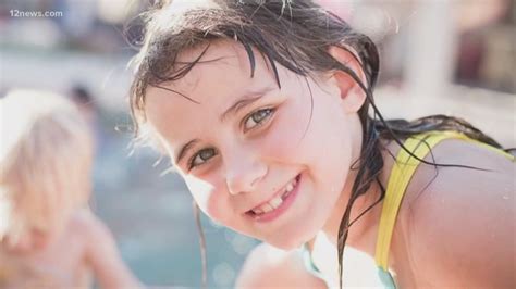 6th Degree Burn Survivor