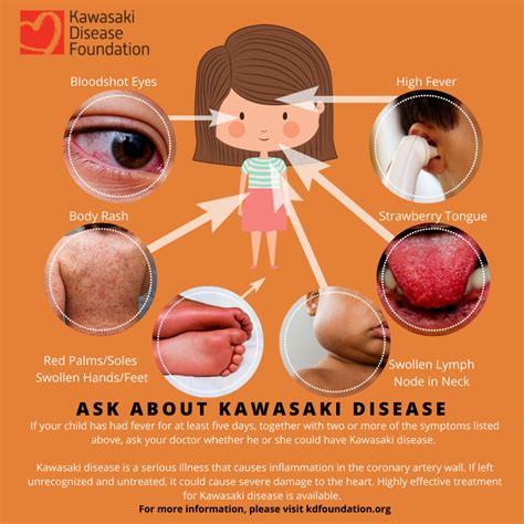 How Rare Is Kawasaki Disease