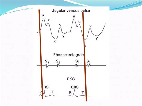 Jugular venous pressure | PPTX