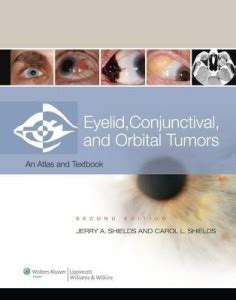 Eyelid, Conjunctival, and Orbital Tumors: Buy Eyelid, Conjunctival, and ...