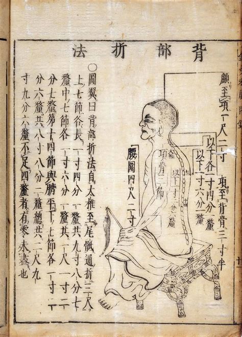 Acupuncture for Pain: Complementary Medicine That Works