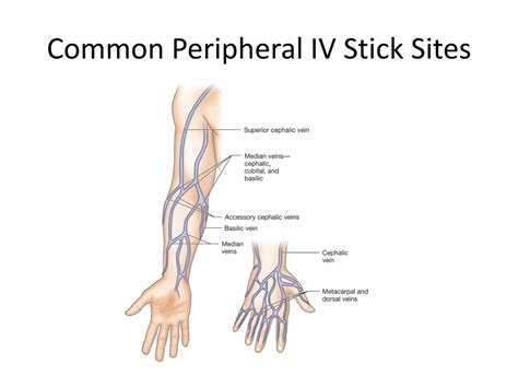 PPT - Infusion Therapy PowerPoint Presentation, free download - ID:258149