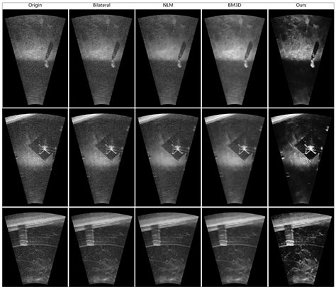 SimNFND: A Forward-Looking Sonar Denoising Model Trained on Simulated ...