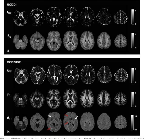 Tensor veli palatini | Semantic Scholar
