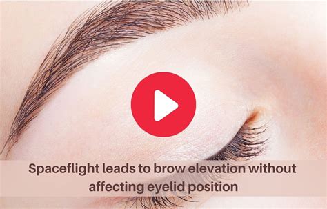Spaceflight can cause brow elevation without eyelid position change