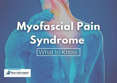 myofascial pain syndrome vs fibromyalgia
