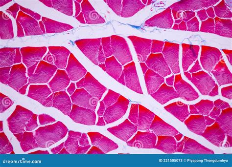 Image result for Skeletal Muscle Tissue Under Microscope
