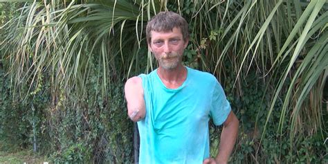 Man who lost arm during alligator attack says it was ‘do or die’