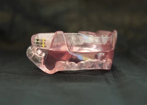 Adjusting your mandibular advancement device | Grand.Dental