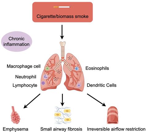 Frontiers | Inflammation mechanism and research progress of COPD