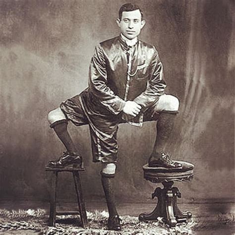 A comovente trajetória de Frank Lentini: o artista com três pernas, 16 ...