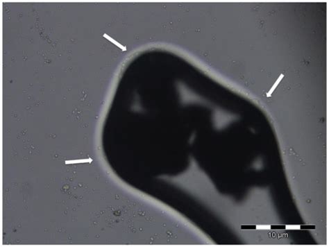 Biocleaning to Remove Graffiti: A Real Possibility? Advances towards a ...