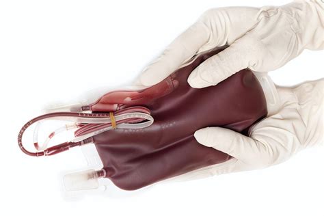 熊猫血、黄金血、恐龙血，人体共38种血型分类系统 - 知乎