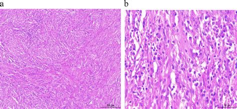 Spindle Shape 的图像结果