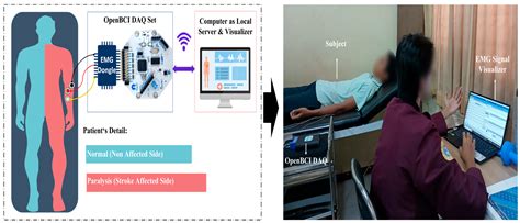 EMG-Spectrogram-Empowered CNN Stroke-Classifier Model Development