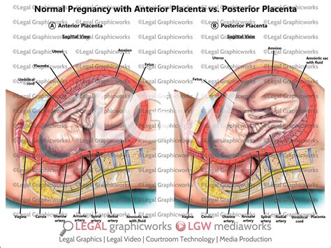 Normal Pregnancy with Anterior Placenta vs. Posterior Placenta – LGWgo
