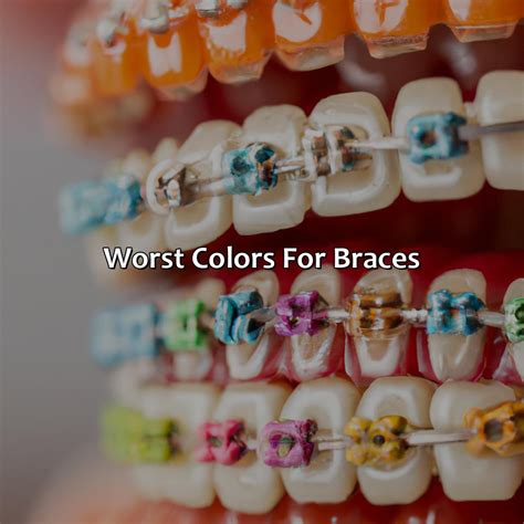 What Color Is The Best Color For Braces at Jonathan Landseer blog