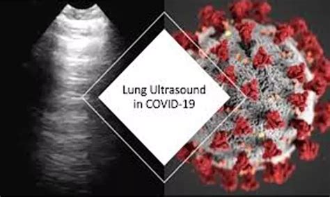 Lung ultrasound with patients'characteristics can accurately identify ...