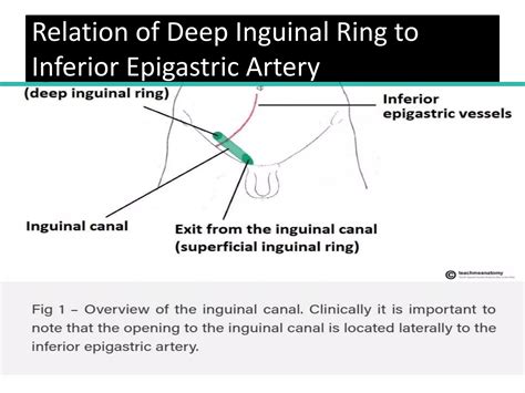 Abdoman ppt 2 (Inguinal region).pptx