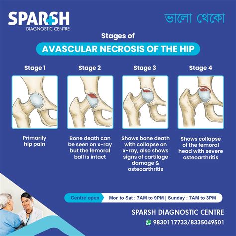 Avascular Necrosis of the Hip - Sparsh Diagnostic Center