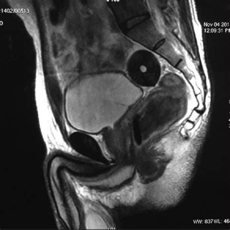 Image result for Mouse Intraperitoneal Space