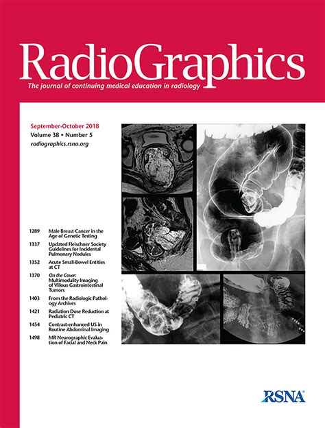 Updated Fleischner Society Guidelines for Managing Incidental Pulmonary ...