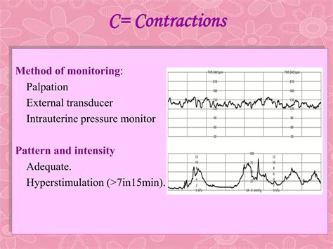 fetal monitoring (2).ppt