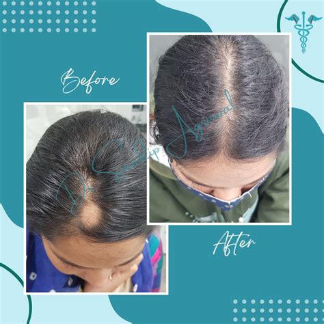 Treatment Gallery - Dr. Sandip Agrawal