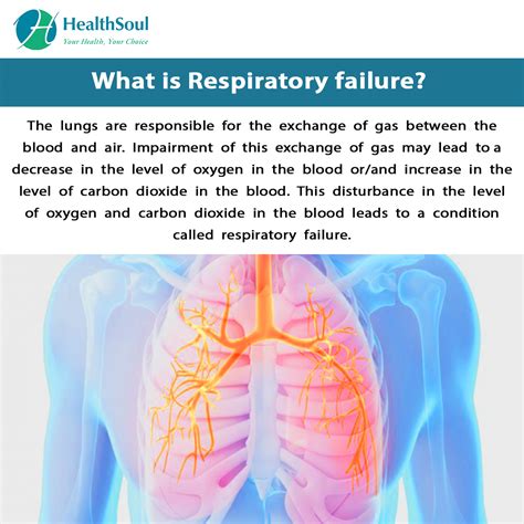 Respiratory Failure