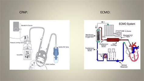 Amniotic Fluid Meconium Stained