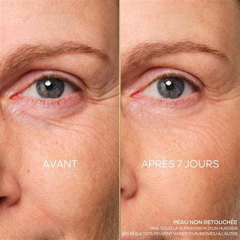 Abeille Royale ⋅ Soin Yeux Réparateur Jeunesse ⋅ GUERLAIN