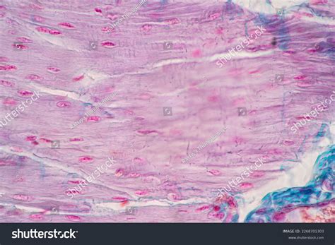 Cardiac Muscle Tissue Under Microscope