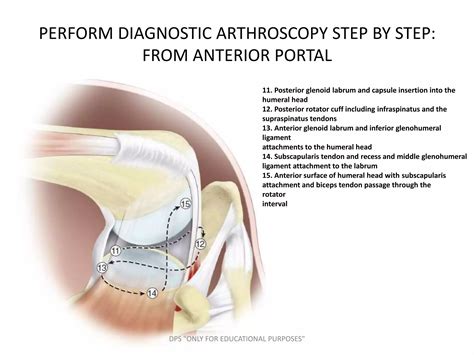 Diagnostic shoulder arthroscopy | PPTX