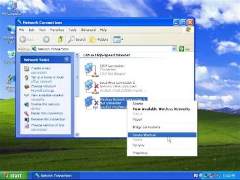 Image result for Local Area Connection Windows XP Drivers Download