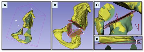 Feasibility and Accuracy of a Dual-Function AR-Guided System for PSI ...