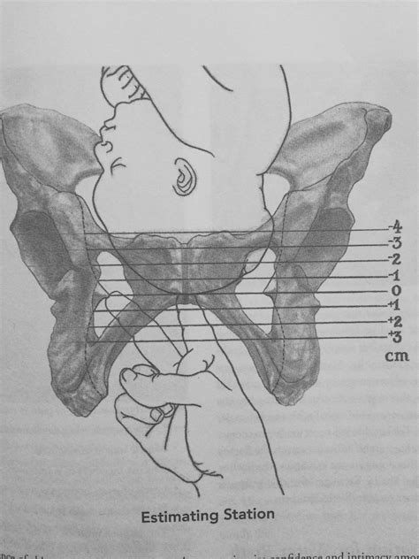 5 acupressure points to induce labor do they work – Artofit