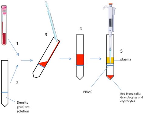 Optimization of Peripheral Blood Mononuclear Cell Extraction from Small ...